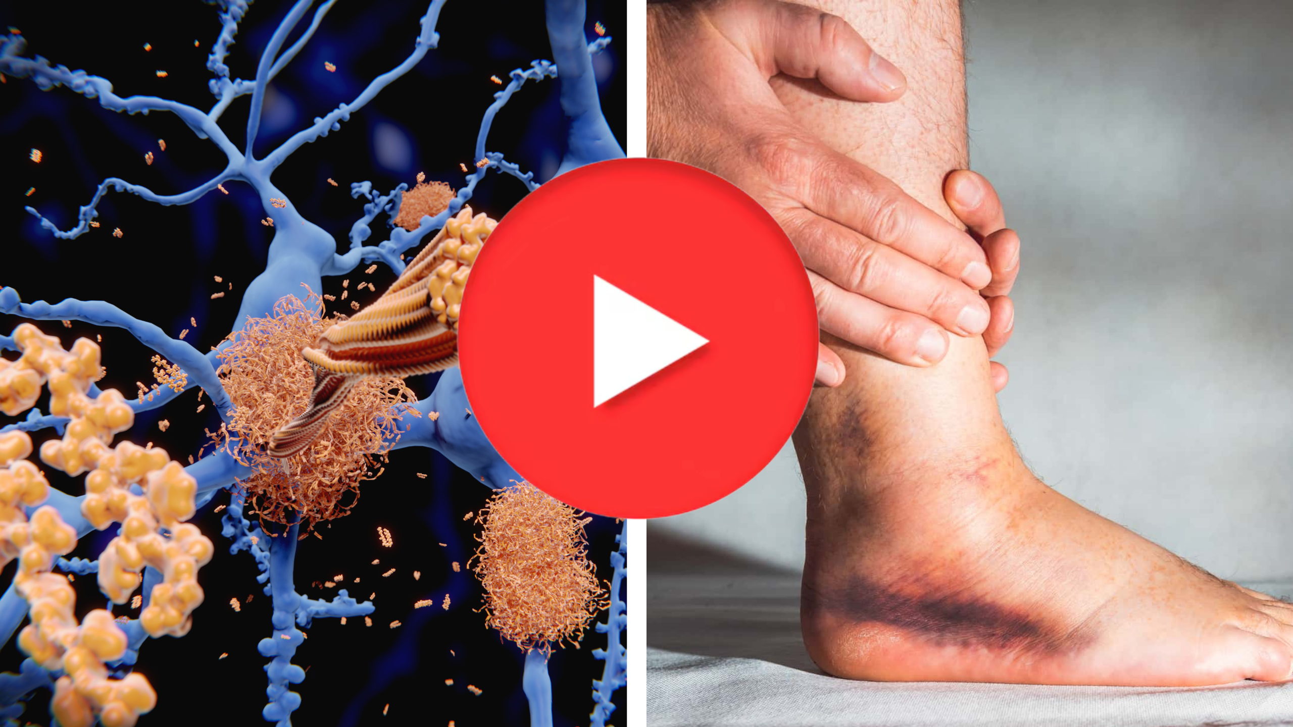Neuropathy Ritual Thumbnail